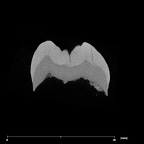 SK 75 Paranthropus robustus LRM3 internal