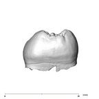 SK 75 Paranthropus robustus LRM3 mesial