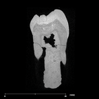 SK 7 Paranthropus robustus LRP4 internal