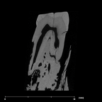 SK 821 Paranthropus robustus ULP3 internal