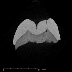 SK 822 Paranthropus robustus ULP3 internal