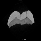 SK 822 Paranthropus robustus ULP3 internal