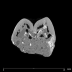 SK 824 Paranthropus robustus ULP4 internal