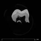 SK 826a2 Paranthropus robustus ULM2 internal