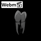 SK 826b.SK 828 Paranthropus robustus partial left hemimandible ct stack movie