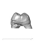 SK  829 Paranthropus robustus ULM1 mesial
