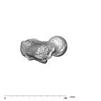 SK 82 Paranthropus robustus right femur inferior