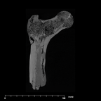 SK 82 Paranthropus robustus right femur internal