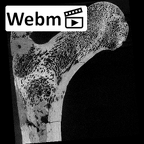 SK 82 Paranthropus robustus right femur proximal ct stack movie