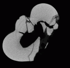 SK 831 Paranthropus robustus LRP3 gif
