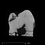 SK 831 Paranthropus robustus LRP3 internal