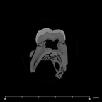 SK 831a Paranthropus robustus partial left maxilla internal ULM3