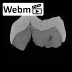 SK 832 Paranthropus robustus ULM1 ct stack movie