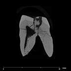 SK 834 Paranthropus robustus URM2 internal