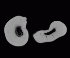 SK 835 Paranthropus robustus ULM3 gif