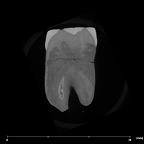 SK 838b Paranthropus robustus LLM1 internal