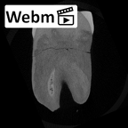 SK 838b Paranthropus robustus LLM1 ct stack movie