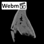 SK 839 Paranthropus robustus ULI1 ct stack movie