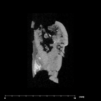 SK 839 Paranthropus robustus ULI2 internal