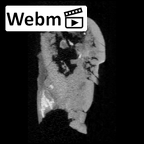SK 839 Paranthropus robustus ULI2 ct stack movie
