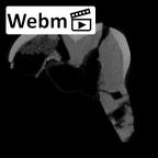SK 839 Paranthropus robustus URDM1 ct stack movie