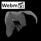 SK 839 Paranthropus robustus URDM2 ct stack movie
