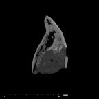 SK 839 Paranthropus robustus URI1 internal