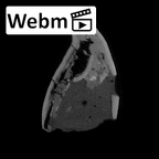 SK 839 Paranthropus robustus URI1 ct stack movie