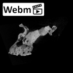 SK 83 Paranthropus robustus cranium ct stack movie