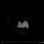 SK 841a Paranthropus robustus partial mandible internal LLM1