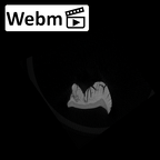 SK 841a Paranthropus robustus partial mandible ct stack movie