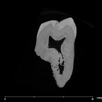 SK 841b Paranthropus robustus LLM3 internal