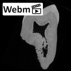 SK 841b Paranthropus robustus LLM3 ct stack movie