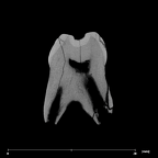 SK 842 Paranthropus robustus LLDM2 internal