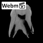 SK 842 Paranthropus robustus LLDM2 ct stack movie