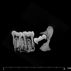 SK 843 Paranthropus robustus partial mandible internal