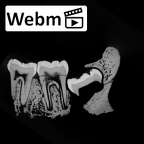 SK 843 Paranthropus robustus partial mandible ct stack movie