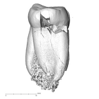SK 846a Paranthropus robustus LRM1 distal
