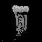 SK 846a Paranthropus robustus LRM1 internal