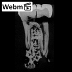 SK 846a Paranthropus robustus LRM1 ct stack movie