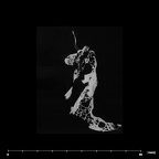 SK 847 Homo left temporal internal
