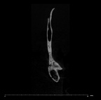 SK 847d Homo cranial fragment internal