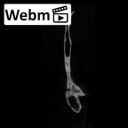SK 847d Homo cranial fragment ct stack movie