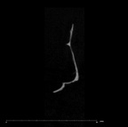 SK 847l Homo cranial fragment 6 internal