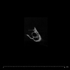SK 847n Homo cranial fragment internal