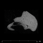 SK 848 Paranthropus robustus right malleus internal