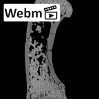 SK 84 Homo left first metacarpal ct stack movie