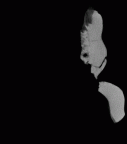 SK 851 Paranthropus robustus LRM3 gif