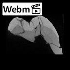 SK 851 Paranthropus robustus LRM3 ct stack movie