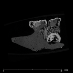 SK 852 Paranthropus robustus partial right hemimandible internal